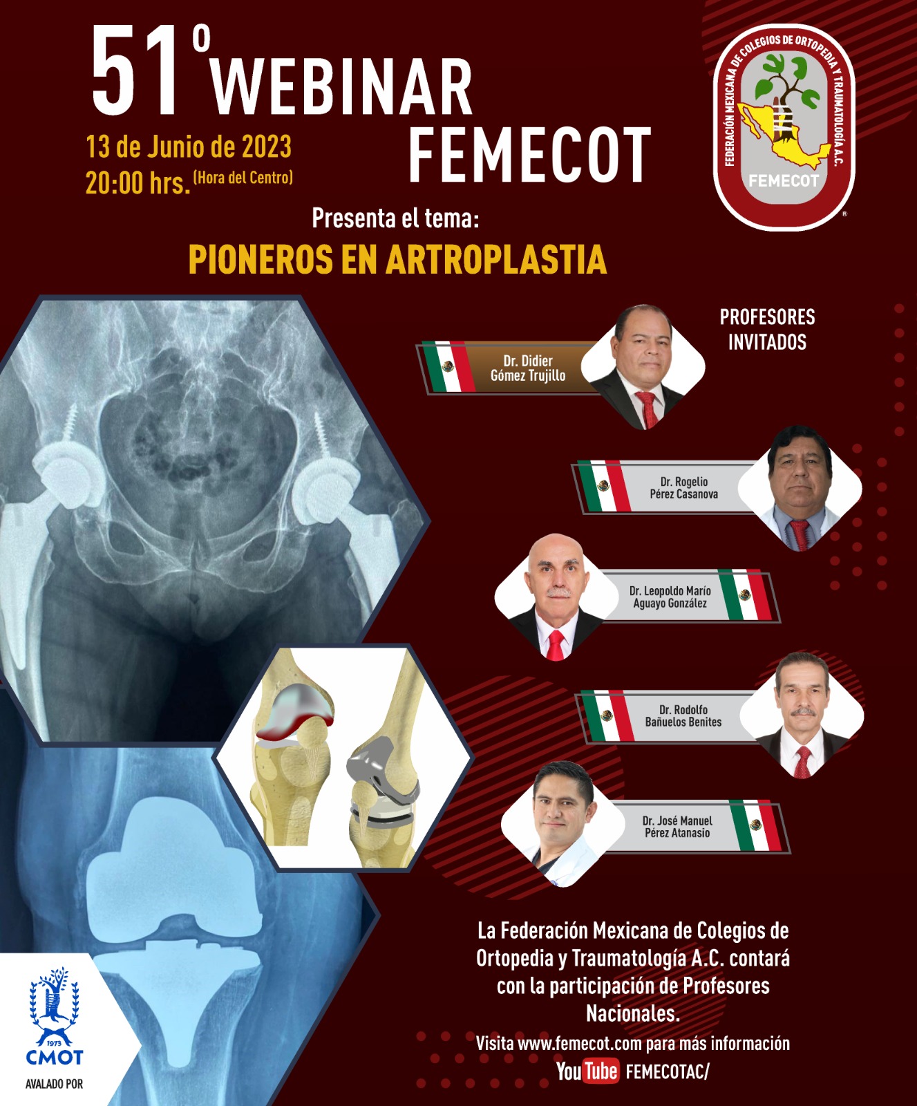 51er Webinar FEMECOT: Pionero en artroplastia